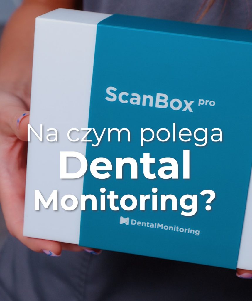 Pudełko do skanowania Dental Monitoring używane w ortodoncji do monitorowania leczenia aparatami stałymi